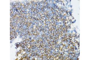 Immunohistochemistry (Paraffin-embedded Sections) (IHC (p)) image for anti-Ubiquitin-Conjugating Enzyme E2D 1 (UBE2D1) antibody (ABIN7259985)