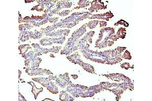 IHC analysis of ALDH1A1 using anti-ALDH1A1 antibody (ABIN7602127).