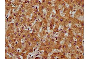 IHC image of ABIN7149663 diluted at 1:200 and staining in paraffin-embedded human liver tissue performed on a Leica BondTM system. (Transmembrane 7 Superfamily Member 4 (TM7SF4) (AA 119-209) 抗体)