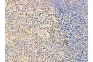 ABIN6257955 and ABIN6273780 at 1/100 staining human normal tonsil tissue by IHC-P. (BAG2 抗体  (C-Term))