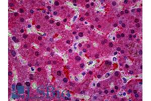 Immunohistochemistry (IHC) image for anti-Potassium Intermediate/small Conductance Calcium-Activated Channel, Subfamily N, Member 4 (KCNN4) (Internal Region) antibody (ABIN6391378)