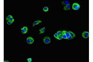 Immunofluorescent analysis of MCF-7 cells using ABIN7153609 at dilution of 1:100 and Alexa Fluor 488-congugated AffiniPure Goat Anti-Rabbit IgG(H+L) (GJB2 抗体  (AA 99-131))