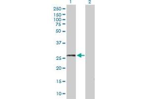 Western Blot analysis of DDAH2 expression in transfected 293T cell line by DDAH2 MaxPab polyclonal antibody. (DDAH2 抗体  (AA 1-285))