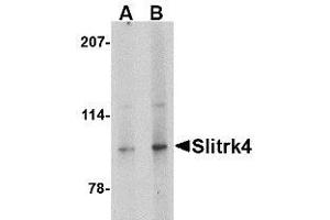 Image no. 1 for anti-SLIT and NTRK-Like Family, Member 4 (SLITRK4) (C-Term) antibody (ABIN1492201) (SLITRK4 抗体  (C-Term))