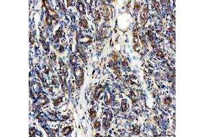 IHC analysis of SDHA using anti-SDHA antibody (ABIN3043324).