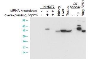 Western blot using Sephs2 polyclonal antibody  shows detection of Sephs2 in NIH/3T3 cells over-expressing this protein.