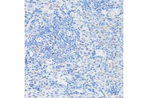 Immunohistochemistry of paraffin-embedded rat spleen using CASP3 antibody. (Caspase 3 抗体  (AA 55-160))