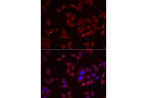Immunofluorescence analysis of U2OS cells using PFKFB3 antibody (ABIN5974173). (PFKFB3 抗体)