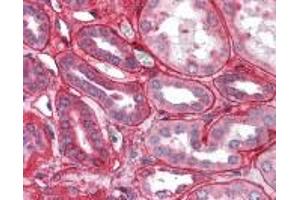 Immunohistochemistry (IHC) image for anti-Collagen, Type IV (COL4) (C-Term) antibody (ABIN2470570) (Collagen IV 抗体  (C-Term))