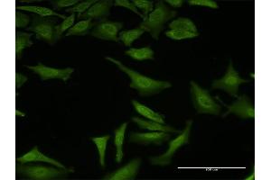 anti-Splicing Factor 3b, Subunit 3, 130kDa (SF3B3) (AA 819-929) antibody