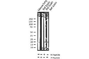 Western Blotting (WB) image for anti-Stathmin 1 (STMN1) (pSer25) antibody (ABIN6255120)
