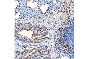 IHC analysis of RAB7/RAB7A using anti-RAB7/RAB7A antibody (ABIN7600597). (RAB7A 抗体  (AA 21-177))