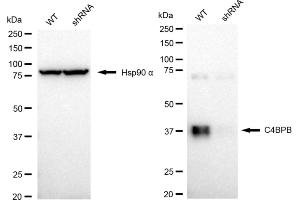 anti-Complement Component 4 Binding Protein, beta (C4BPB) antibody