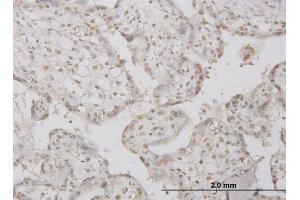 anti-Protein Phosphatase 1, Regulatory (Inhibitor) Subunit 2 (PPP1R2) (AA 1-100) antibody