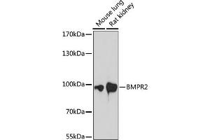 Western blot analysis of extracts of various cell lines, using BMPR2 antibody (ABIN7265906) at 1:1000 dilution. (BMPR2 抗体  (AA 27-150))