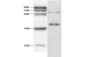 WB analysis of recombinant Hepatitis E virus ORF 3, using HEV ORF3 antibody. (HEV ORF3 抗体  (AA 34-123))
