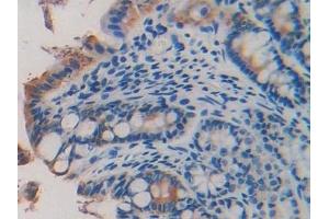 Immunohistochemistry (IHC) image for anti-Laminin, beta 2 (Laminin S) (LAMB2) (AA 1498-1716) antibody (ABIN7438904)