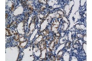 Formalin-fixed and paraffin embedded rat kidney labeled with Anti- CXCL11 Polyclonal Antibody, Unconjugated  followed by conjugation to the secondary antibody and DAB (CXCL11 抗体  (AA 22-100))