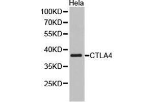 Western Blotting (WB) image for anti-Cytotoxic T-Lymphocyte-Associated Protein 4 (CTLA4) antibody (ABIN1872073) (CTLA4 抗体)