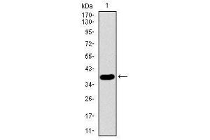 Image no. 3 for anti-Surfactant Protein C (SFTPC) antibody (ABIN1491610) (Surfactant Protein C 抗体)