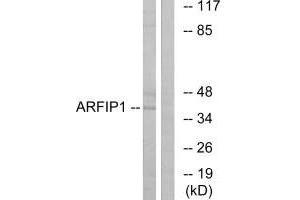 Western blot analysis of extracts from Jurkat cells, using ARFIP1 antibody. (ARFIP1 抗体)