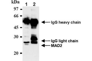 Western Blotting (WB) image for anti-MAD2 Mitotic Arrest Deficient-Like 1 (Yeast) (MAD2L1) antibody (ABIN567786) (MAD2L1 抗体)