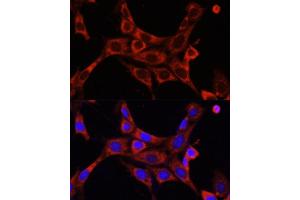 Immunofluorescence analysis of NIH/3T3 cells using IR antibody (ABIN6130497, ABIN6142514, ABIN6142515 and ABIN6216327) at dilution of 1:100. (IRAK1 抗体  (AA 424-633))