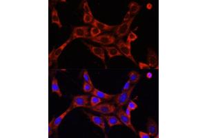Immunofluorescence analysis of NIH/3T3 cells using IR antibody (ABIN6130497, ABIN6142514, ABIN6142515 and ABIN6216327) at dilution of 1:100. (IRAK1 抗体  (AA 424-633))