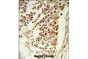 Formalin-fixed and paraffin-embedded human testis tissue reacted with CENPH Antibody (Center), which was peroxidase-conjugated to the secondary antibody, followed by DAB staining. (CENPH 抗体  (AA 136-162))