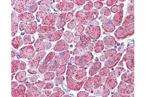 Anti-AKT antibody IHC of human heart. (AKT1/2 抗体)