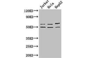 Western Blot Positive WB detected in: Jurkat whole cell lysate, Hela whole cell lysate, HepG2 whole cell lysate All lanes: YTHDF2 antibody at 2. (YTHDF2 抗体  (AA 201-500))