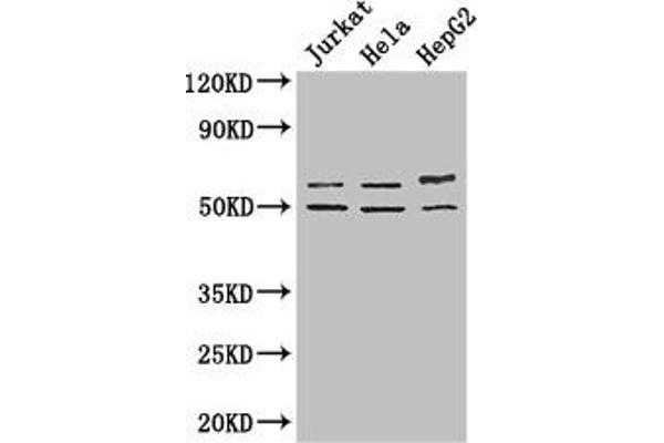 YTHDF2 anticorps  (AA 201-500)