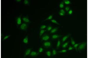 Immunofluorescence analysis of U2OS cells using SSRP1 Polyclonal Antibody (SSRP1 抗体)