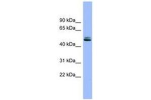 Image no. 1 for anti-serine Peptidase Inhibitor, Kunitz Type 1 (SPINT1) (AA 395-444) antibody (ABIN6743332) (SPINT1 抗体  (AA 395-444))