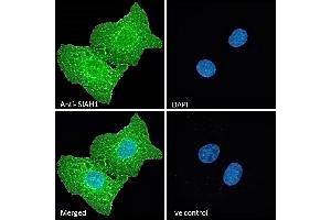(ABIN184675) Immunofluorescence analysis of paraformaldehyde fixed U2OS cells, permeabilized with 0. (SIAH1 抗体  (N-Term))