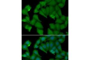 Immunofluorescence analysis of MCF7 cells using HBA1 Polyclonal Antibody (HBA1 抗体)