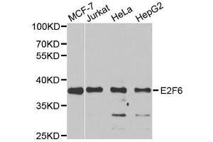Western blot analysis of extracts of various cell lines, using E2F6 antibody. (E2F6 抗体)