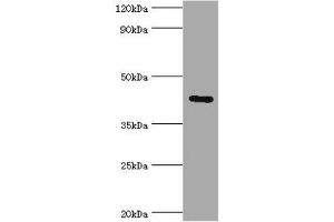 Western blot All lanes: Gap junction gamma-1 protein antibody at 6 μg/mL + 293T whole cell lysate Secondary Goat polyclonal to rabbit IgG at 1/10000 dilution Predicted band size: 45 kDa Observed band size: 45 kDa (GJC1 抗体  (AA 247-396))