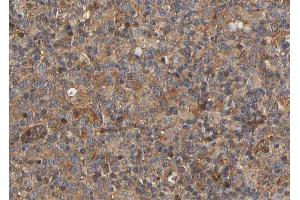 Immunohistochemistry (IHC) image for anti-Mannose Receptor, C Type 2 (MRC2) (N-Term) antibody (ABIN6263346)