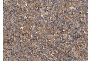 ABIN6266864 at 1/100 staining human lymph node tissue sections by IHC-P. (MRC2 抗体  (N-Term))