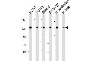 SRGAP2 antibody  (C-Term)