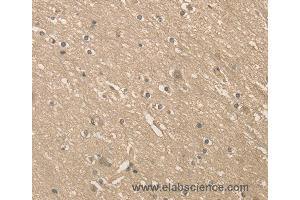Immunohistochemistry of Human brain  using ALDH8A1 Polyclonal Antibody at dilution of 1:40 (ALDH8A1 抗体)