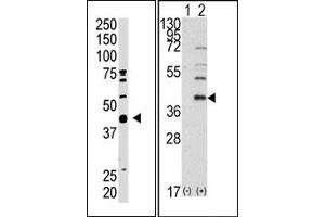 Image no. 2 for anti-SUMO1 Activating Enzyme Subunit 1 (SAE1) (C-Term) antibody (ABIN357744) (SAE1 抗体  (C-Term))