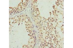 Immunohistochemistry of paraffin-embedded human testis tissue using ABIN7163477 at dilution of 1:100 (PIWIL1 抗体  (AA 390-690))