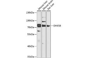 Western blot analysis of extracts of various cell lines, using DHX58 antibody (ABIN6129372, ABIN6139609, ABIN6139610 and ABIN6224272) at 1:1000 dilution. (DHX58 抗体  (AA 389-678))