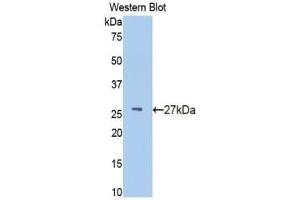 Western blot analysis of recombinant Human IFNa/bR1. (IFNAR1 抗体  (AA 28-227))
