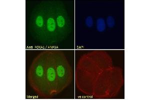 Immunofluorescence (IF) image for anti-Forkhead Box A1 (FOXA1) (C-Term) antibody (ABIN185021)