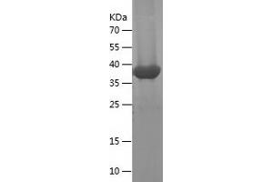 Western Blotting (WB) image for Interleukin 18 (IL18) (AA 37-193) protein (His-IF2DI Tag) (ABIN7123563) (IL-18 Protein (AA 37-193) (His-IF2DI Tag))