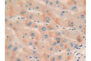 Detection of CCND2 in Human Liver Tissue using Polyclonal Antibody to Cyclin D2 (CCND2) (Cyclin D2 抗体  (AA 68-278))