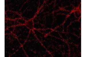Indirect immunostaining of rat hippocampus neurons (dilution 1 : 500). (Bassoon 抗体)